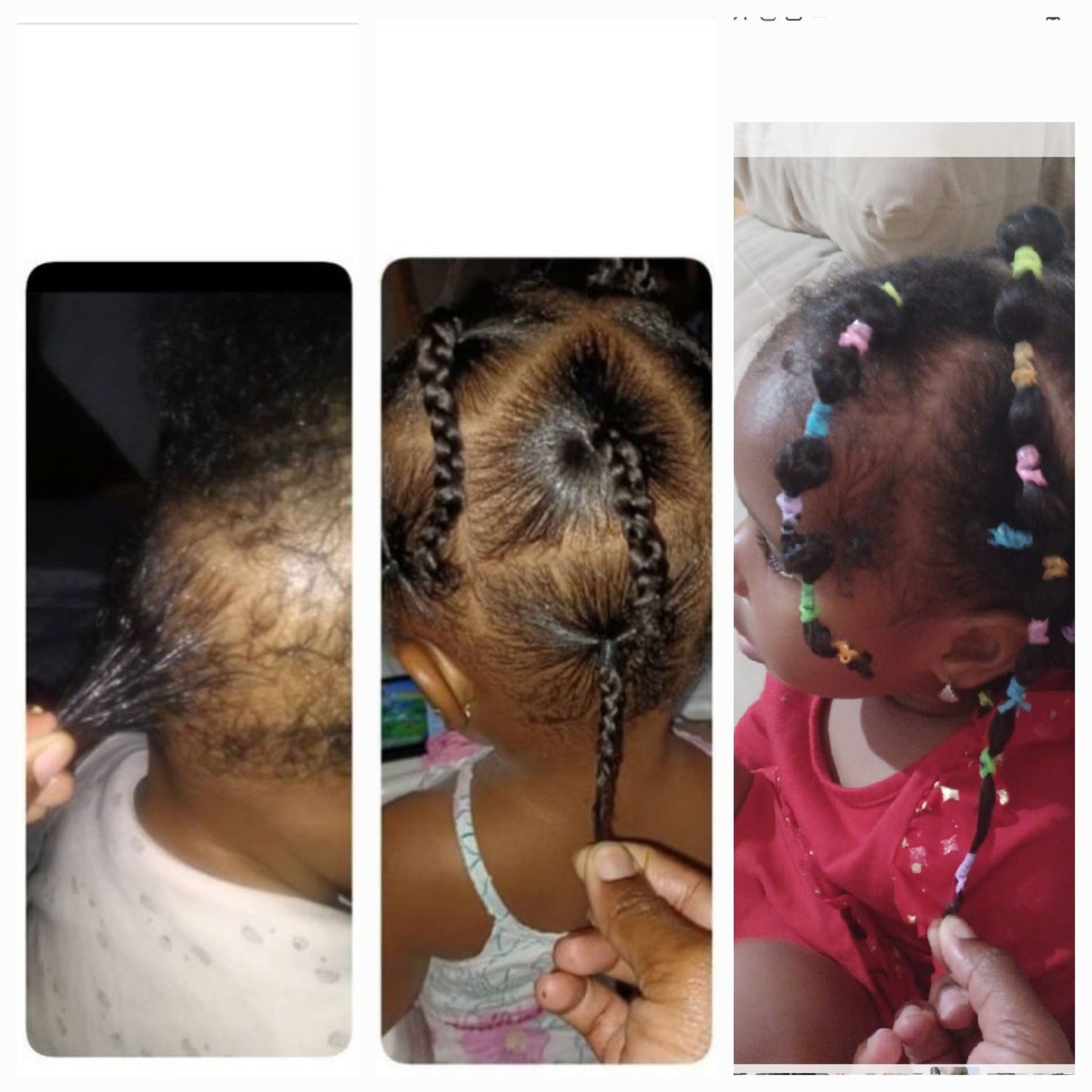 Sheesa CrownEssentials™ Bundle