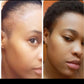 Grow and Restore Edge Treatment