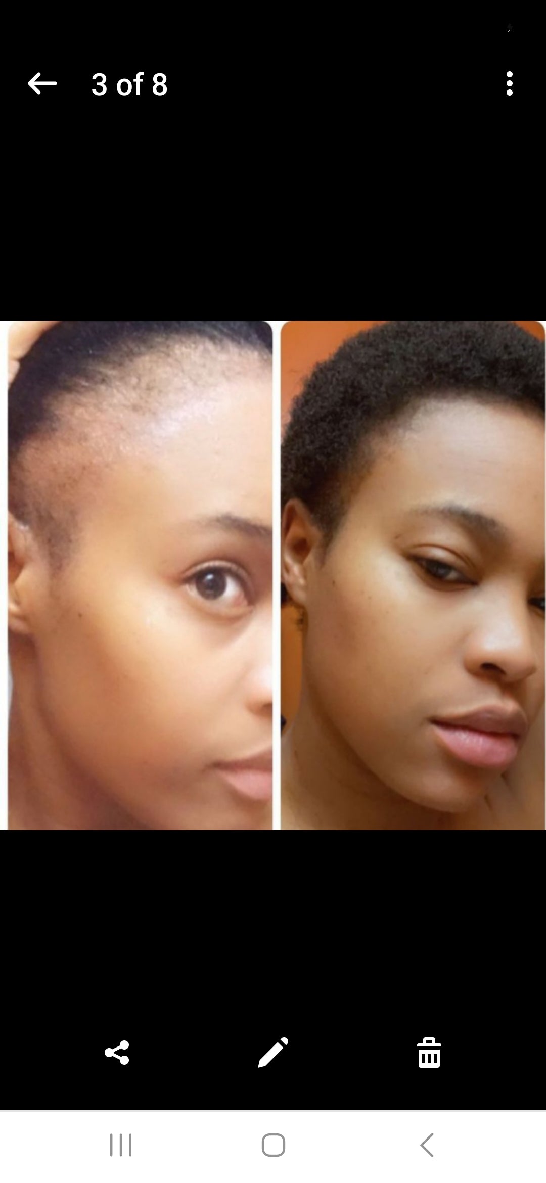 Grow and Restore Edge Treatment