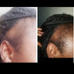 Grow and Restore Edge Treatment